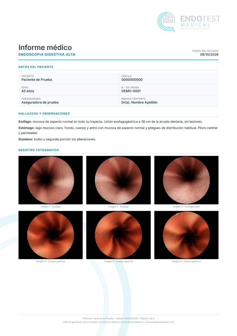 Primera página de un informe de endoscopia digestiva alta generado con el sistema: datos del paciente, hallazgos y registro fotográfico